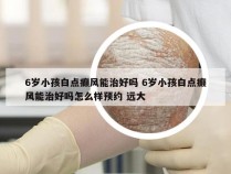 6岁小孩白点癫风能治好吗 6岁小孩白点癫风能治好吗怎么样预约 远大