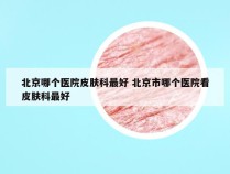 北京哪个医院皮肤科最好 北京市哪个医院看皮肤科最好