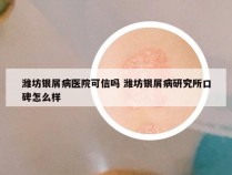 潍坊银屑病医院可信吗 潍坊银屑病研究所口碑怎么样