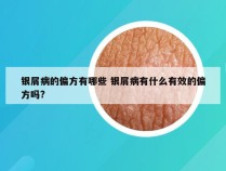 银屑病的偏方有哪些 银屑病有什么有效的偏方吗?