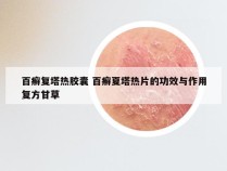 百癣复塔热胶囊 百癣夏塔热片的功效与作用复方甘草