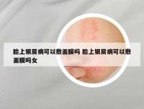 脸上银屑病可以敷面膜吗 脸上银屑病可以敷面膜吗女