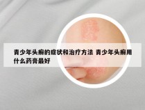 青少年头癣的症状和治疗方法 青少年头癣用什么药膏最好