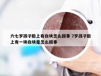 六七岁孩子脸上有白块怎么回事 7岁孩子脸上有一块白块是怎么回事