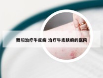 舞阳治疗牛皮癣 治疗牛皮肤癣的医院