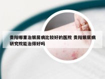 贵阳哪里治银屑病比较好的医院 贵阳银屑病研究院能治得好吗