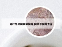 网红牛皮癣真实图片 网红牛图片大全