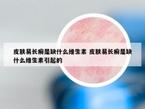 皮肤易长癣是缺什么维生素 皮肤易长癣是缺什么维生素引起的