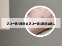 武汉一医院银屑病 武汉一医院银屑病医生