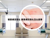 银屑病没变化 银屑病没变化怎么回事