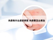 头藓有什么症状表现 头藓要怎么根治