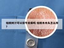 枯桃树汁可以搽牛皮癣吗 枯桃木木头怎么样?