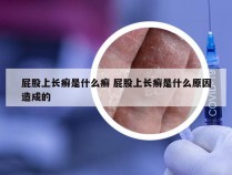 屁股上长癣是什么癣 屁股上长癣是什么原因造成的