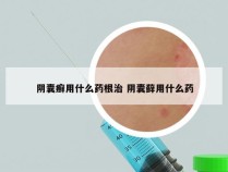 阴囊癣用什么药根治 阴囊藓用什么药