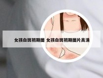 女孩白斑初期图 女孩白斑初期图片高清