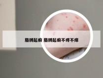 胳膊起癣 胳膊起癣不疼不痒