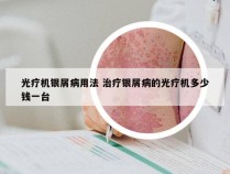 光疗机银屑病用法 治疗银屑病的光疗机多少钱一台