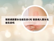 银屑病需要补充维生素C吗 银屑病人要补充维生素吗