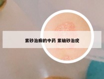 紫砂治癣的中药 紫硇砂治疣