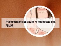 牛皮肤癣病吃韭菜可以吗 牛皮肤癣病吃韭菜可以吗