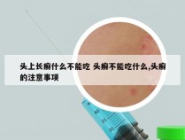 头上长癣什么不能吃 头癣不能吃什么,头癣的注意事项