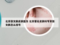 北京张文鹤皮肤医生 北京著名皮肤科专家张文鹤怎么挂号