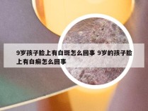 9岁孩子脸上有白斑怎么回事 9岁的孩子脸上有白癣怎么回事