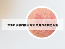 兰寿白点病的根治方法 兰寿白点病怎么治