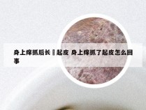 身上痒抓后长廯起皮 身上痒抓了起皮怎么回事