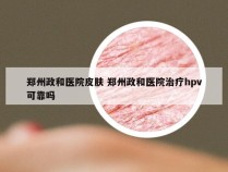 郑州政和医院皮肤 郑州政和医院治疗hpv可靠吗