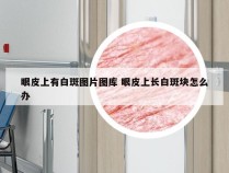 眼皮上有白斑图片图库 眼皮上长白斑块怎么办