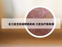 去三亚怎样调理银屑病 三亚治疗银屑病