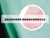 屁股后面长藓很痒 屁股后面长藓很痒怎么办