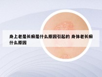 身上老是长癣是什么原因引起的 身体老长癣什么原因