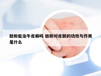 肽粉能治牛皮癣吗 肽粉对皮肤的功效与作用是什么