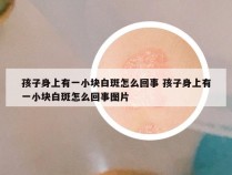 孩子身上有一小块白斑怎么回事 孩子身上有一小块白斑怎么回事图片