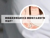 脚癣最简单根治的方法 脚癣有什么症状?如何治疗?