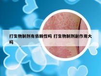 打生物制剂有依赖性吗 打生物制剂副作用大吗