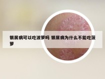 银屑病可以吃波萝吗 银屑病为什么不能吃菠萝