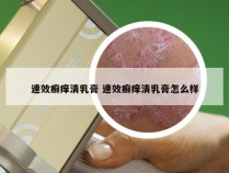 速效癣痒清乳膏 速效癣痒清乳膏怎么样