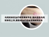 乌司奴单抗治疗银屑病关节炎 国内首款乌司奴单抗上市,银屑病治疗迎来生物制剂元年