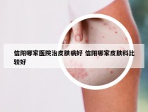 信阳哪家医院治皮肤病好 信阳哪家皮肤科比较好