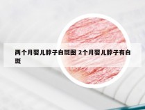 两个月婴儿脖子白斑图 2个月婴儿脖子有白斑