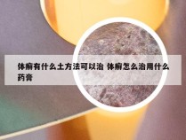 体癣有什么土方法可以治 体癣怎么治用什么药膏