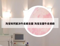 淘宝如何解决牛皮癣主图 淘宝主图牛皮病癣