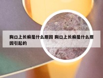 胸口上长癣是什么原因 胸口上长癣是什么原因引起的