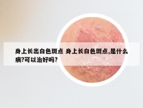 身上长出白色斑点 身上长白色斑点,是什么病?可以治好吗?