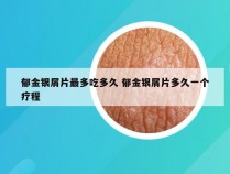 郁金银屑片最多吃多久 郁金银屑片多久一个疗程