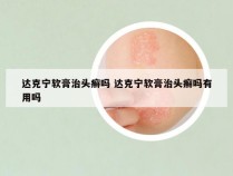 达克宁软膏治头癣吗 达克宁软膏治头癣吗有用吗