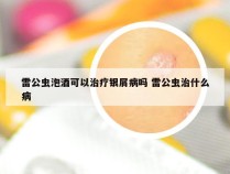 雷公虫泡酒可以治疗银屑病吗 雷公虫治什么病